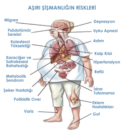 obezite riskleri